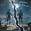 Download track Hurt Me Now (VIP Mix)