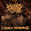 Download track The Woodshed Burial