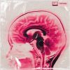 Download track Mind Eraser