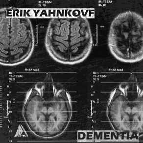 Download track Trauma (Original Mix) Erik Yahnkovf