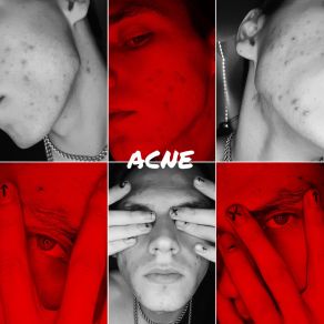 Download track Acne Orlxndo