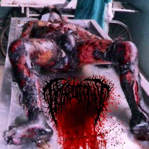 Download track Some Necrophiles Having Sex With Naked Autopsied Bodies In The Morgue Hymenotomy