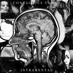 Download track A Thought Passed Through My Mind Contagious Yawns