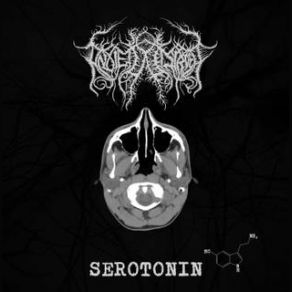 Download track Fading Away Serotonin, Anxiety Disorder