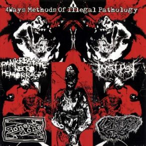 Download track Freak Show Of The Mutilated Bitches Insepsy, BoneAche, Fetal Deformity, Pankreatite Necro Hemorragica