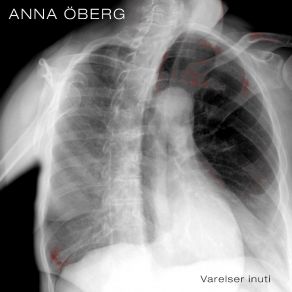 Download track Idiot Anna Öberg