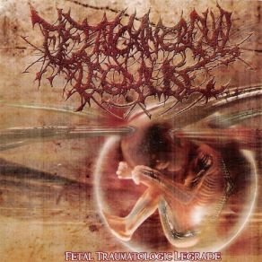 Download track Decompostmortem Of The Antropop Fetal Traumatologic Legrade