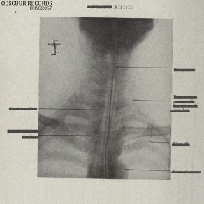 Download track Vortex 001 (Corroid 'Saurestrudel' Remix) Electrorites