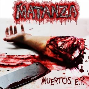 Download track Machete (En Vivo) Matanza