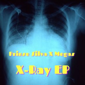 Download track X-Ray Prinse SilvaThe Megas