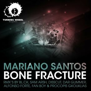 Download track Bone Fracture (Alfonso Forte Remix) Mariano SantosAlfonso Forte