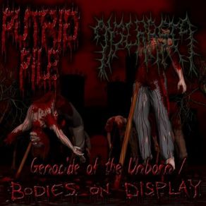 Download track Grinded Into Fetal Sludge Dyscrasia