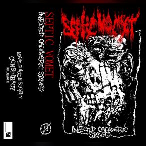 Download track Necrotic Social Structures Septic Vomet